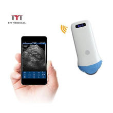 Ultrasound Scanner Portable Color Doppler Convex Probe